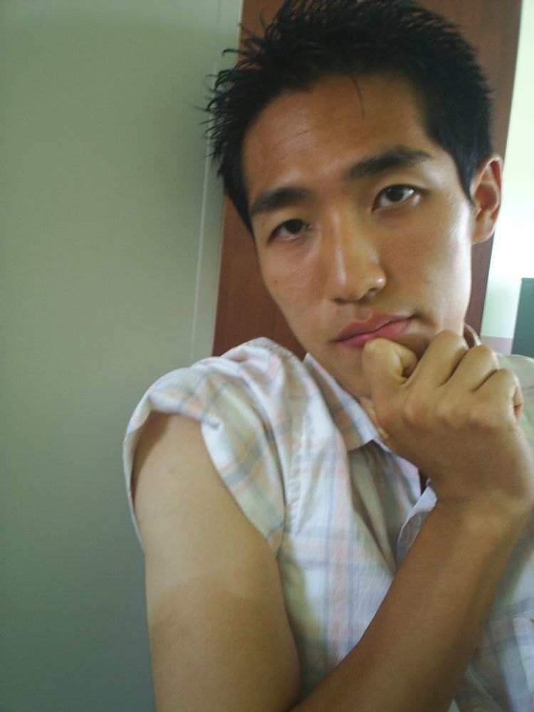 햇빛에 타서 선명하게 생긴 피부 경계선
